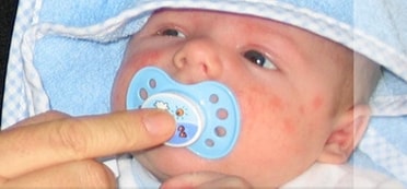 Baby mit blauem Schnuller im Mund, den ein Zeigefinger festhält